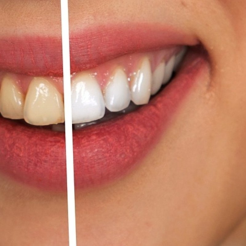 is nicotine gum bad for your teeth